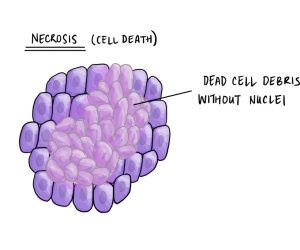 Necrosis-scaled